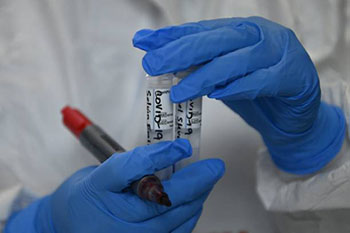 Doctors hands holding vials