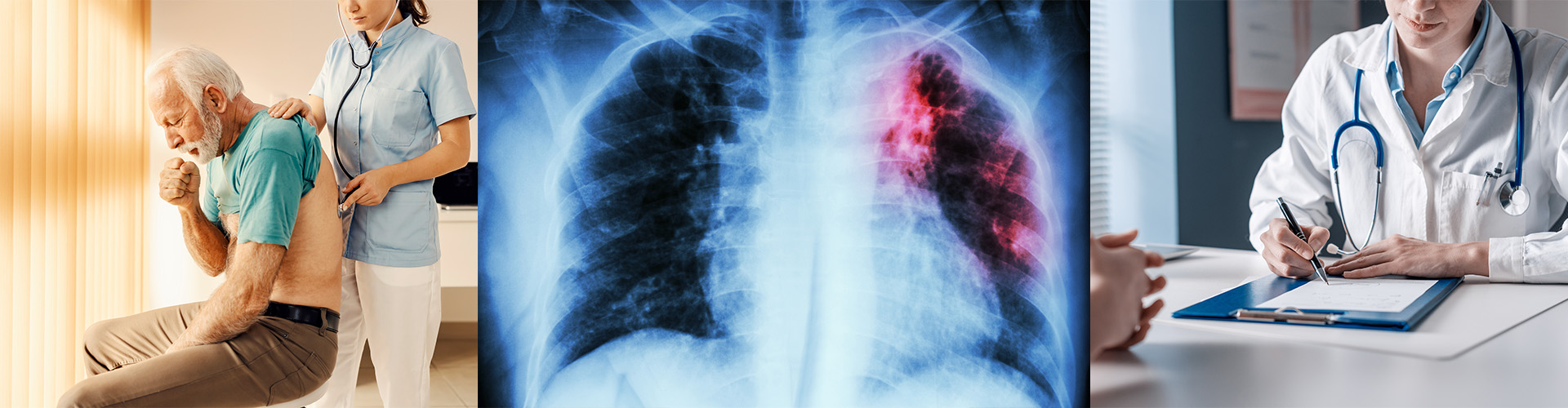 a person coughing while a doctor examines them, a lung x-ray, and a doctor writing a prescription.